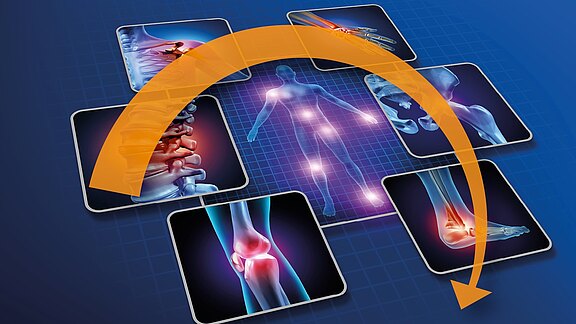 Eine grafische Darstellung zeigt eine menschliche Silhouette, umgeben von verschiedenen Bildern von Gelenken und der Wirbelsäule, die schmerzhafte Bereiche hervorheben. Ein orangefarbener Bogen verbindet die Silhouette mit den Bildern, was auf Schmerzen in verschiedenen Körperteilen hinweist.