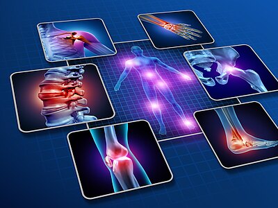 Grafik einer menschlichen Silhouette mit leuchtenden Schmerzpunkten an Gelenken. Umrahmende Detailbilder zeigen Entzündung an Schulter, Handgelenk, Wirbelsäule, Hüfte, Knie und Sprunggelenk. Thema: Gelenk- und Rückenschmerzen, Arthritis.